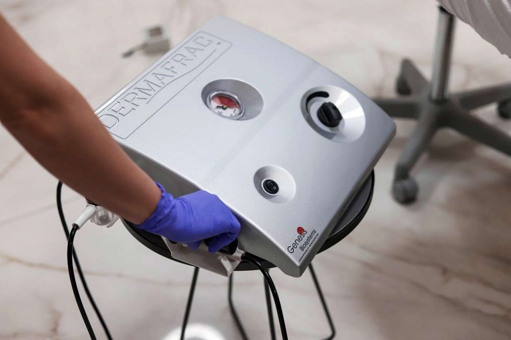 DermaFrac™ Micro-channeling i Micro-Needling - VS Clinic and Beauty