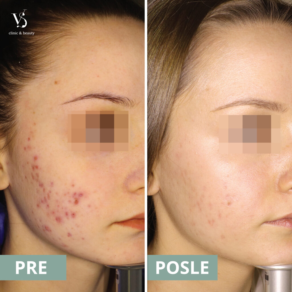 Dr Dubravka Djeric - dermatovenerolog