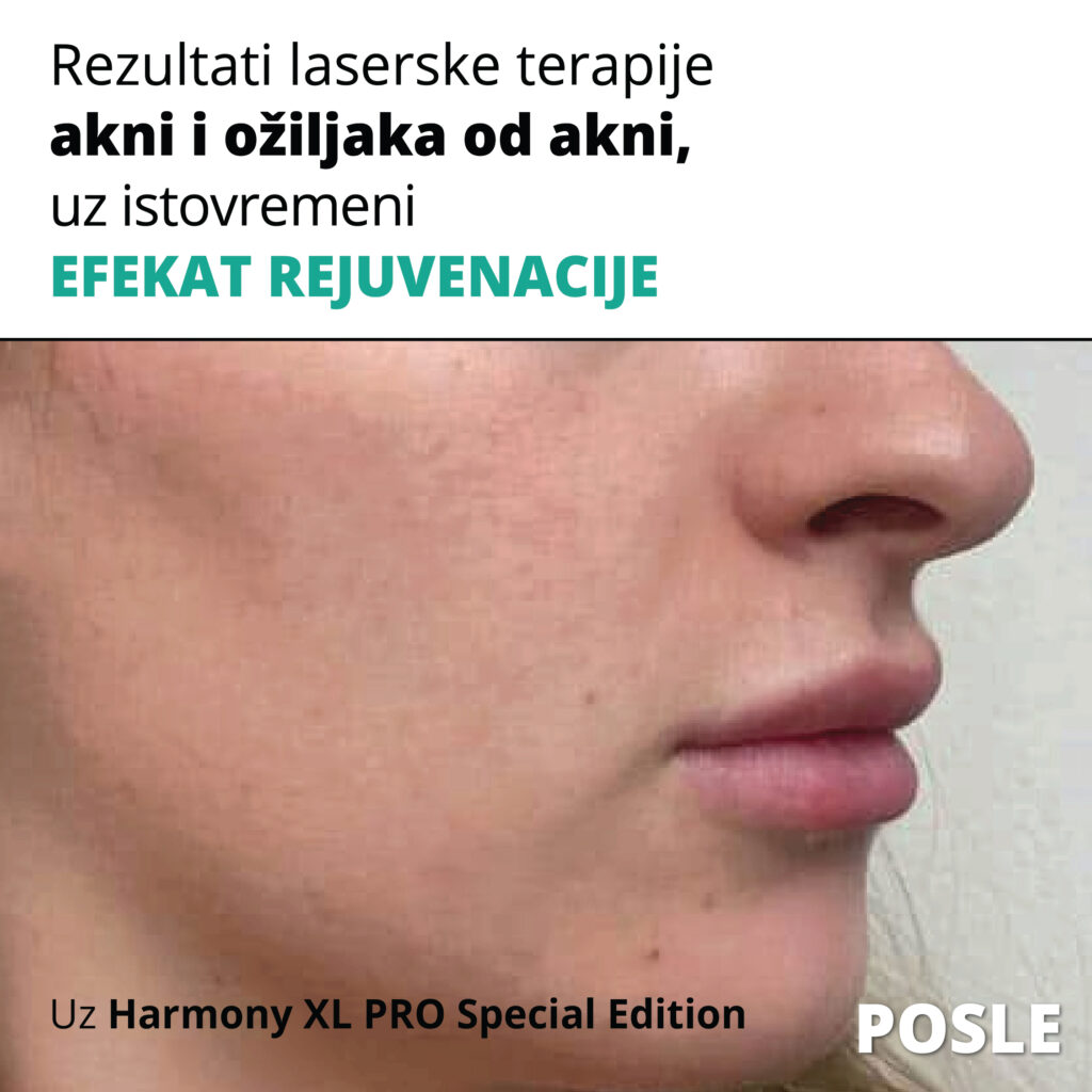 VS Clinic and Beauty - dermatologija