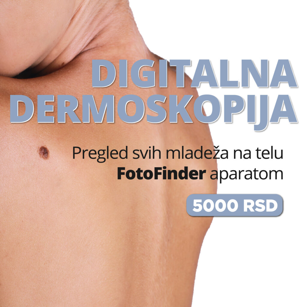 Digitalna dermoskopija